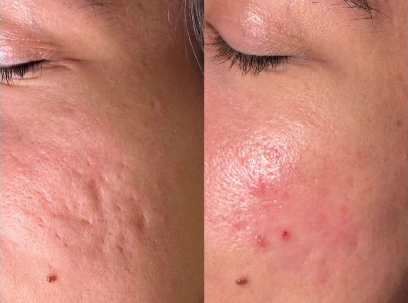 Cellular Radiance Diagnostics
